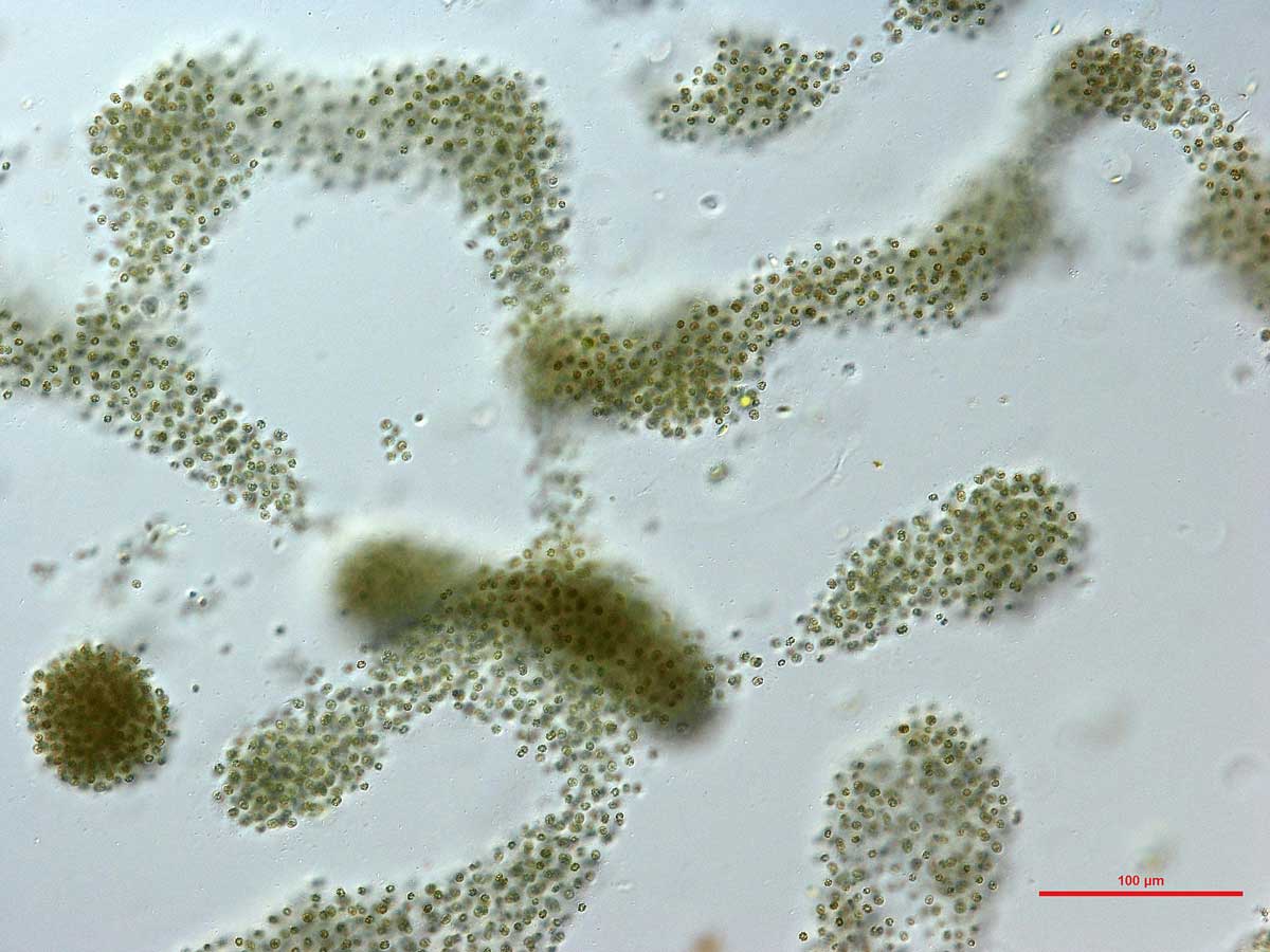  Vi khuẩn lam Anabaena circinalis